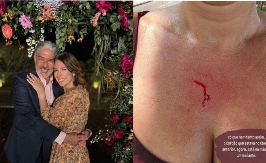 Natasha Dantas esposa de Bonner mostra cortes após ter cordão e